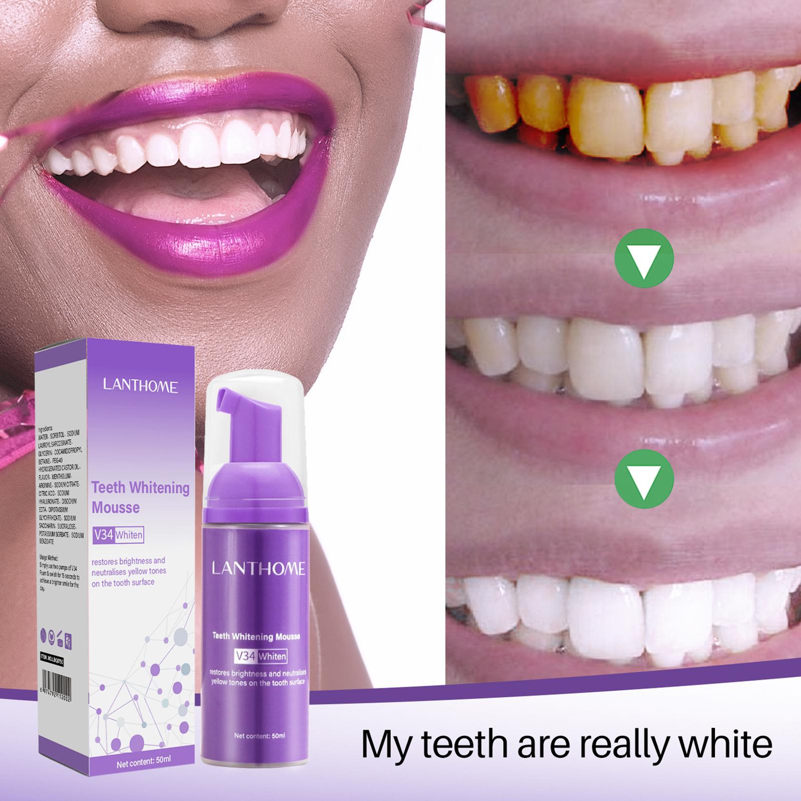 V34 Mousse Teeth Cleaning Toot - огляд і ціна Teeth Whitening Mousse