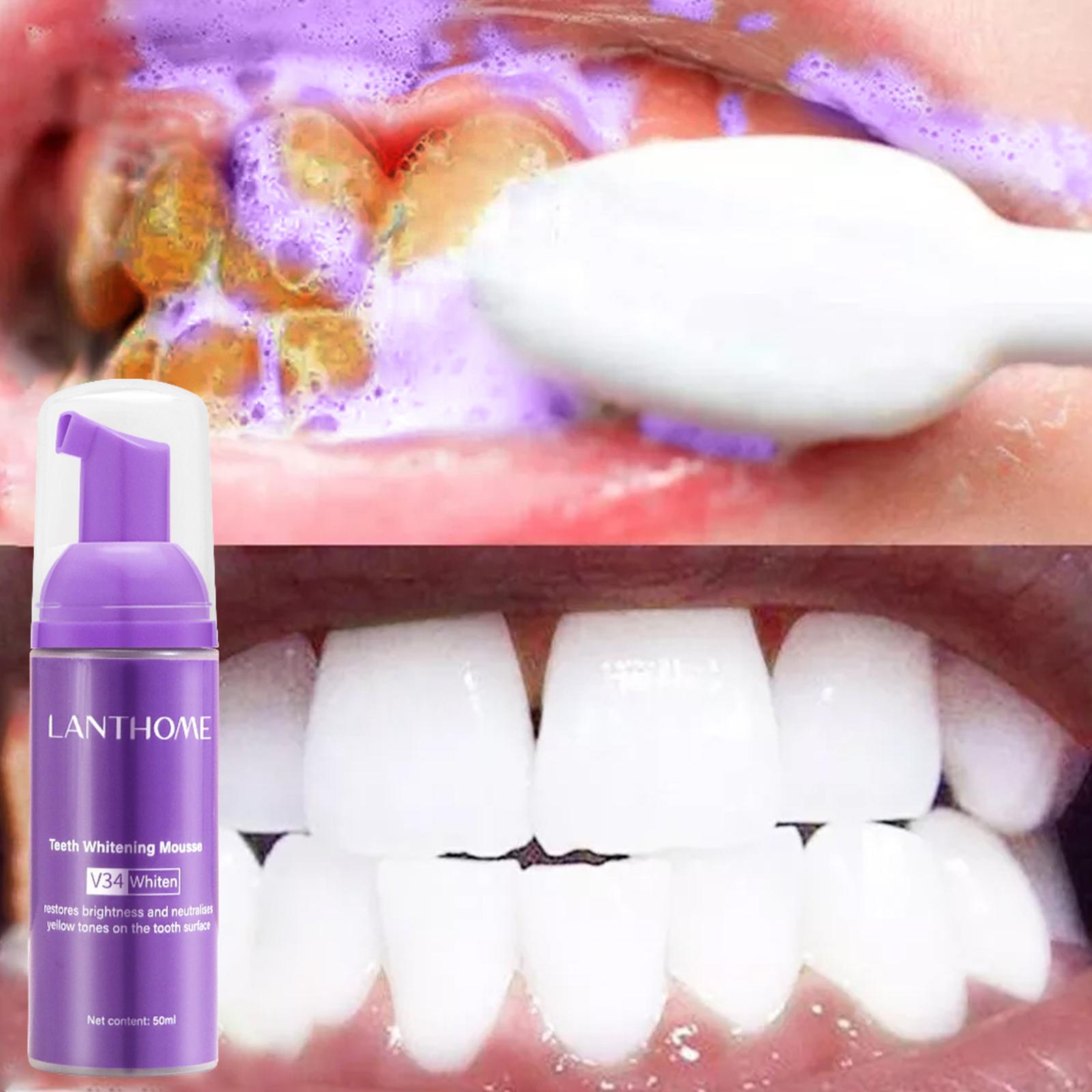 V34 Mousse Teeth Cleaning Toot - огляд і ціна Teeth Whitening Mousse