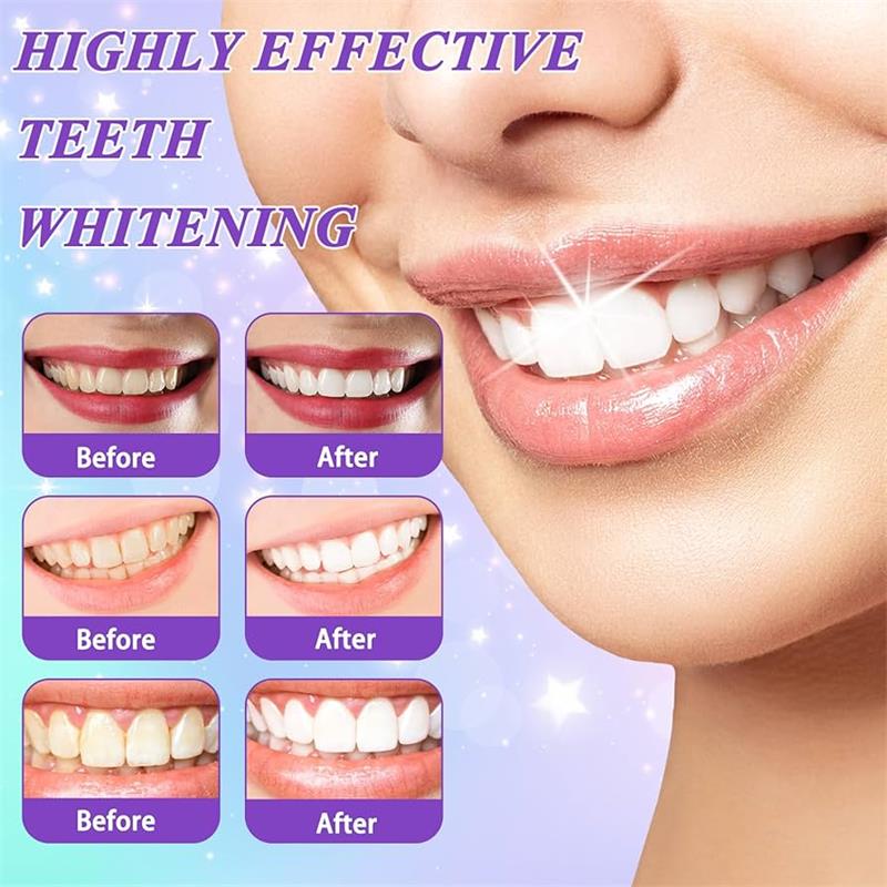 9D Purple Teeth Whitening Toot - огляд і ціна Teeth Whitening Mousse
