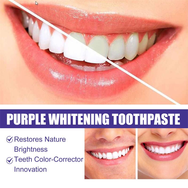 9D Purple Teeth Whitening Toot - огляд і ціна Teeth Whitening Mousse