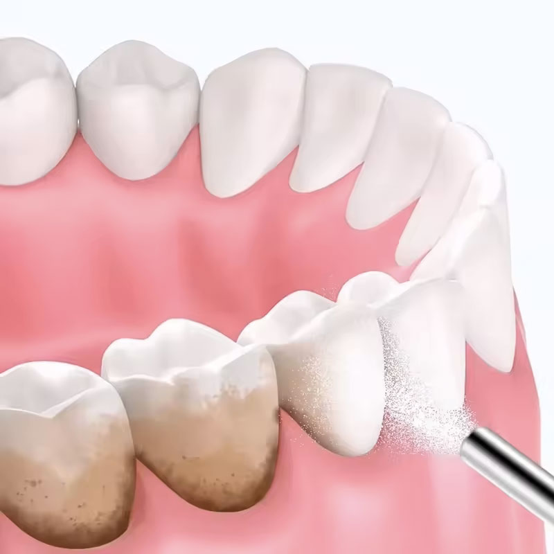 130g Dental Sandblasting Powde - огляд і ціна Teeth Whitening Co