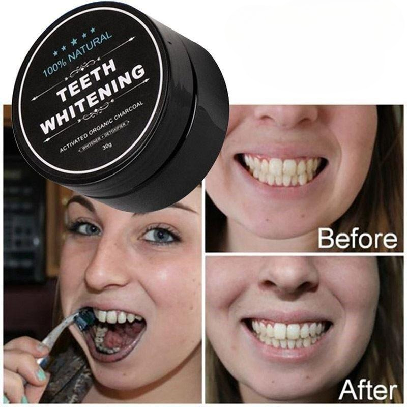 1 Box Activated Charcoal Teeth - огляд і ціна Teeth Whitening Co