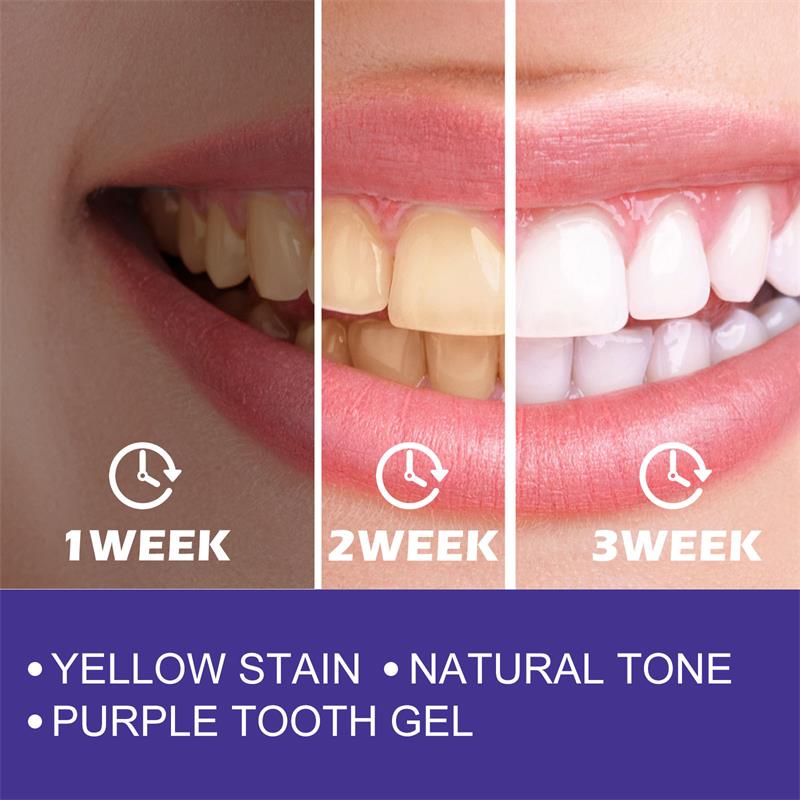 1pcs Teeth Cleansing Whitening - огляд і ціна Teeth Whitening Korea