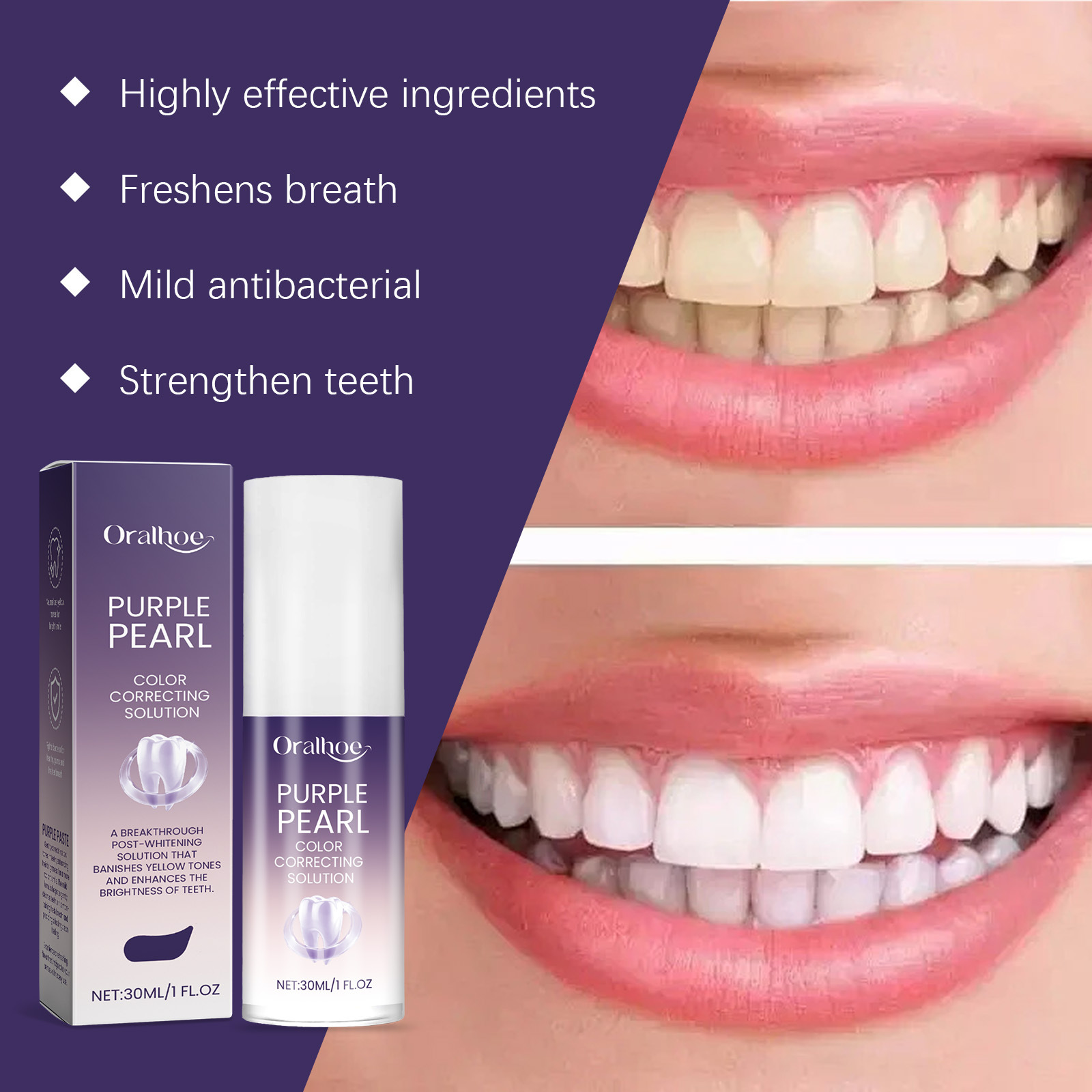 2026 New Purple Teeth Whitenin - огляд і ціна Teeth Whitening Mousse