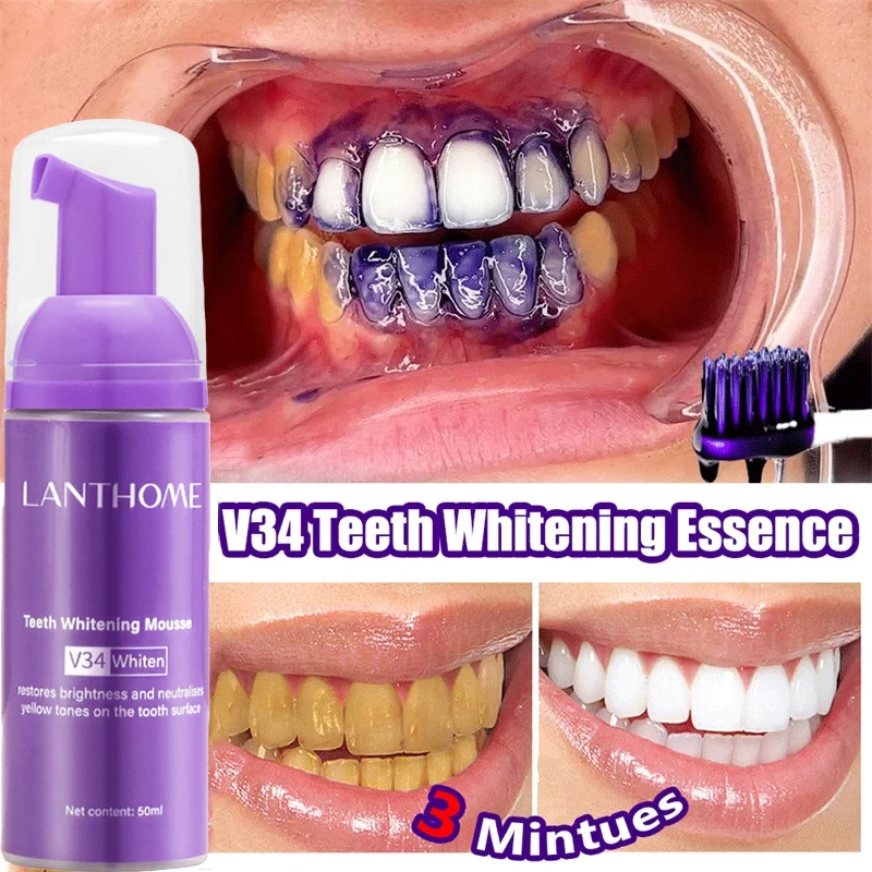 V34 Teeth Whitening Mousse Too - огляд і ціна Teeth Whitening Mousse