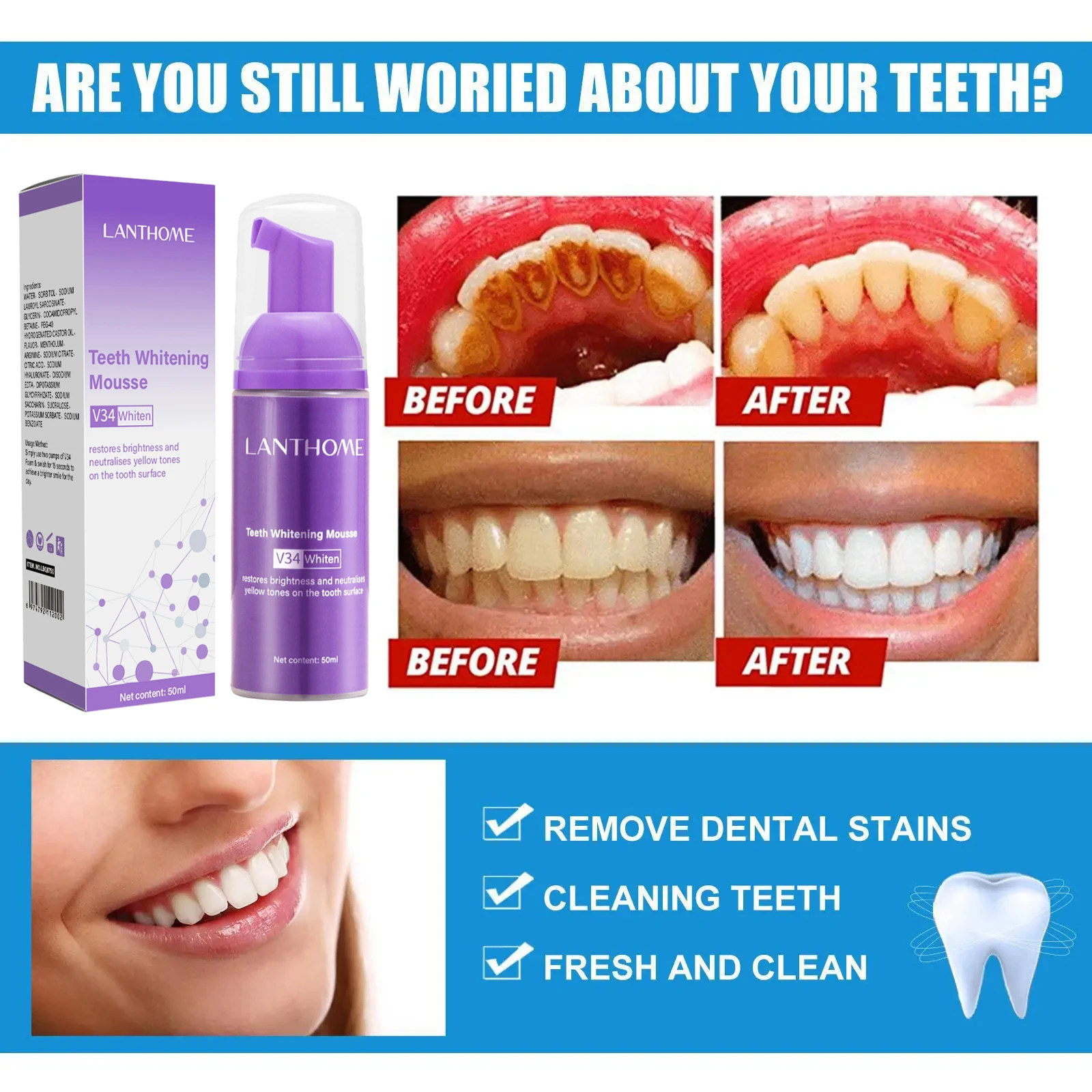 V34 Teeth Whitening Mousse Too - огляд і ціна Teeth Whitening Mousse