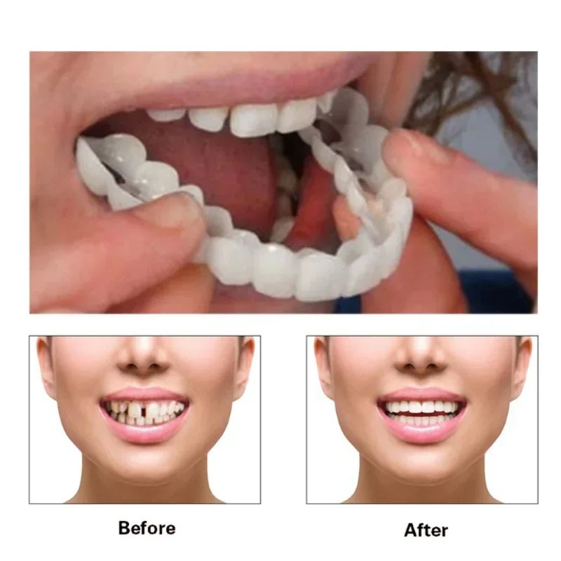 Perfect Fit Teeth Whitening Fa - огляд і ціна Teeth Whitening Mask
