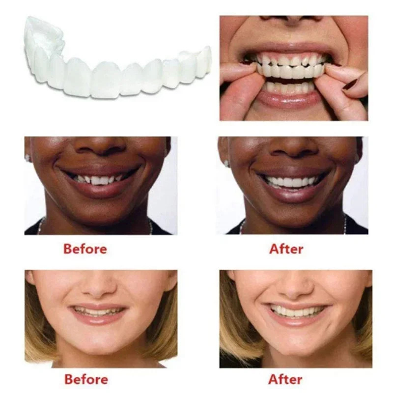 Perfect Fit Teeth Whitening Fa - огляд і ціна Teeth Whitening Mask
