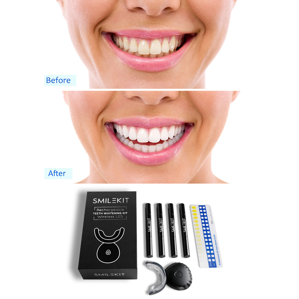 New Electric Teeth Whitening L - огляд і ціна Teeth Whitening Led Kit