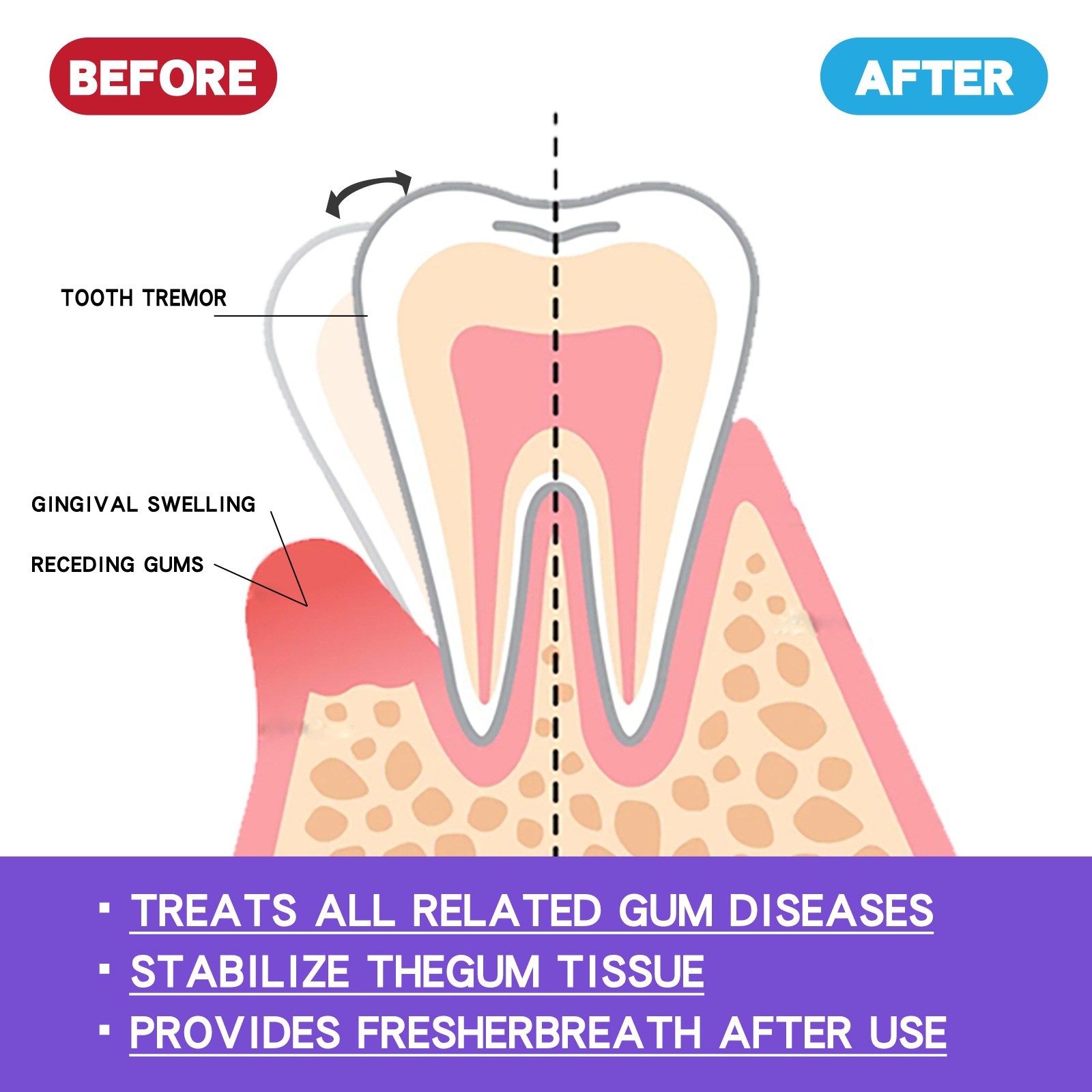 60ml Teeth Whitening Mousse V3 - огляд і ціна Teeth Whitening Mousse