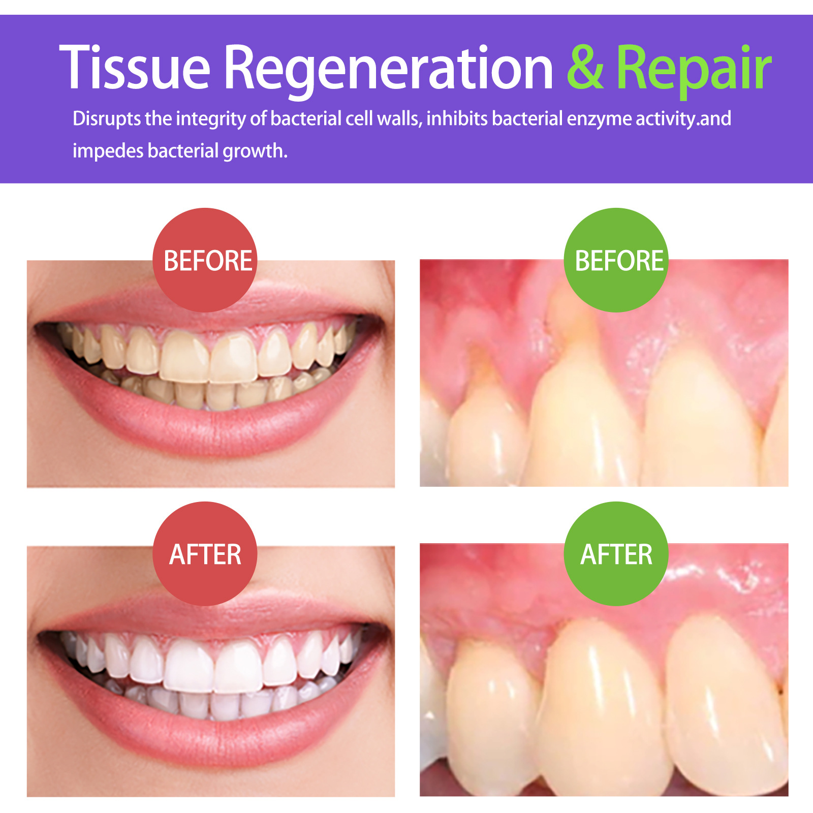 60ml Teeth Whitening Mousse V3 - огляд і ціна Teeth Whitening Mousse